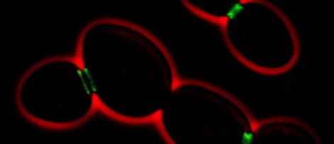 Counting yeast cells