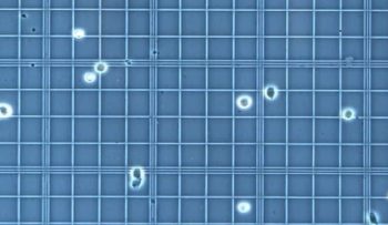 hemocytometer calculation