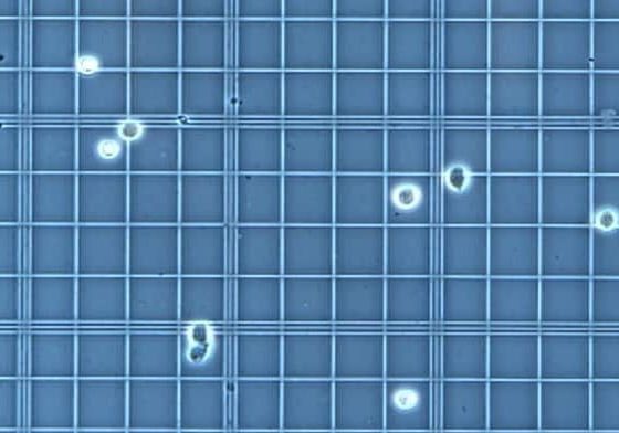 hemocytometer calculation