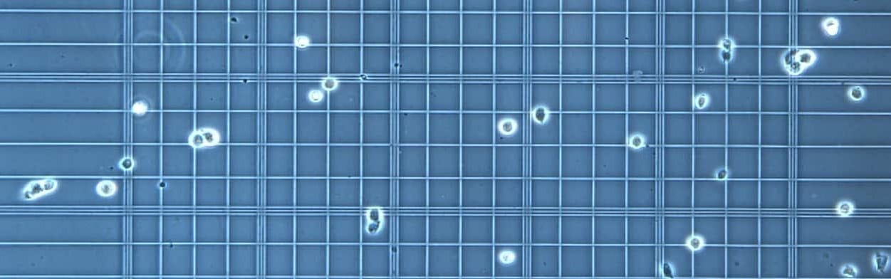 Hemocytometer calculation • Hemocytometer