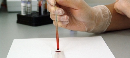 counting blood cells with a hemocytometer
