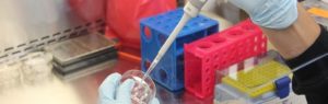 Hemocytometer cell counting equipment